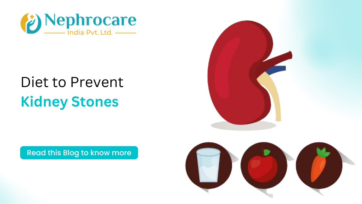 Diet to Prevent Kidney Stone
