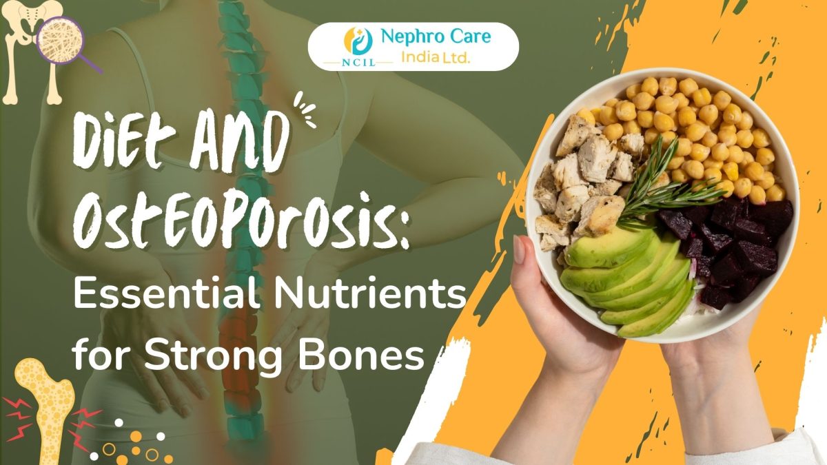 Diet and Osteoporosis: Essential Nutrients for Strong Bones