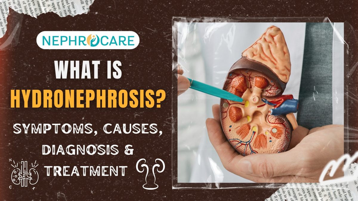 What Is Hydronephrosis? Symptoms, Causes & Treatment