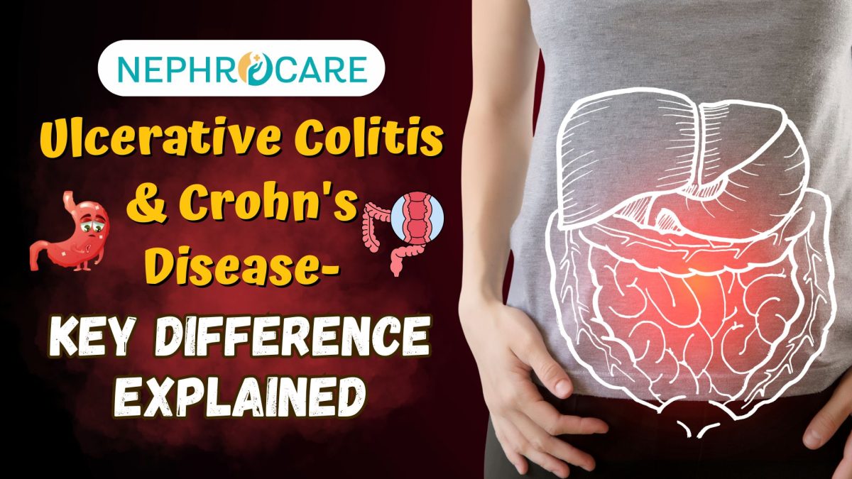 Ulcerative Colitis and Crohn’s Disease – Key Differences Explained