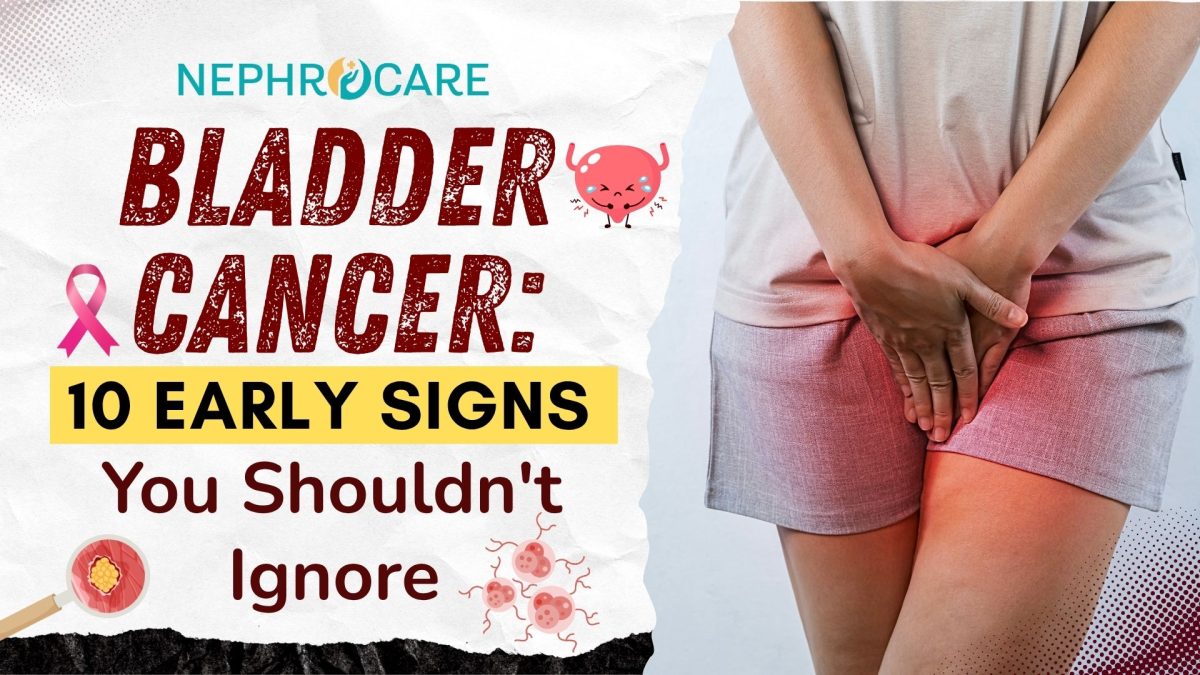 Bladder Cancer: 10 Early Signs You Shouldn’t Ignore