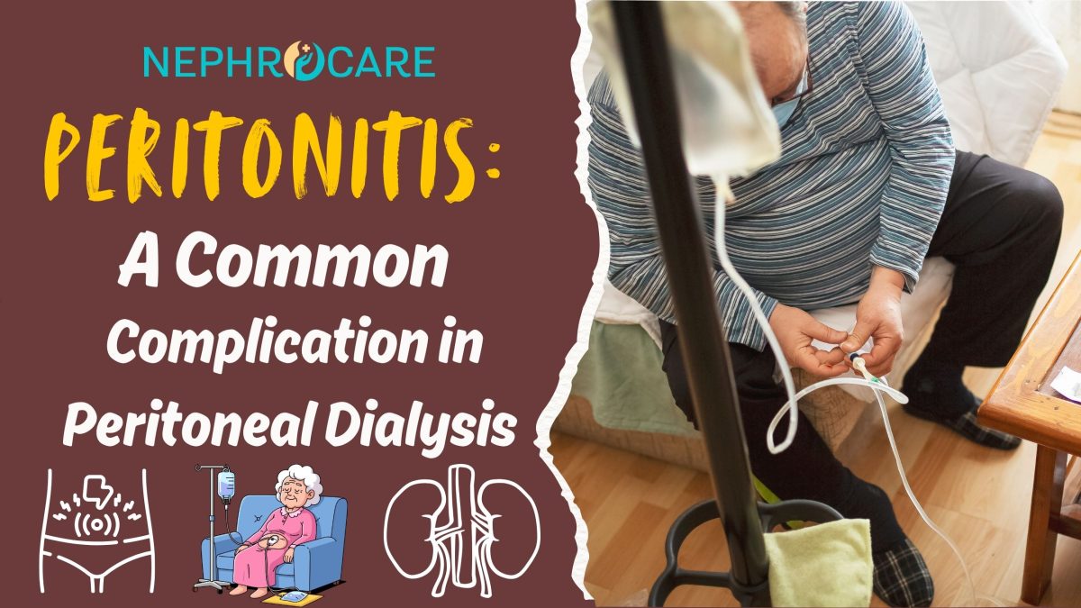 Peritonitis: A Common Complication in Peritoneal Dialysis